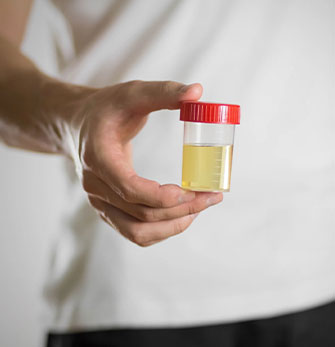 Urine Analysis